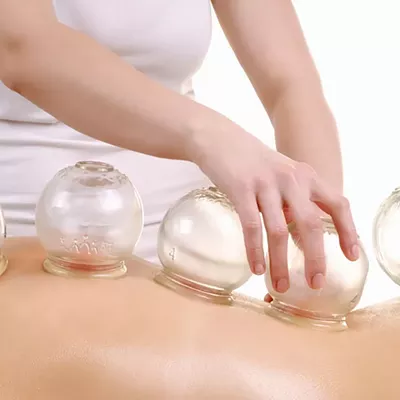 Image: A Reporter Tries Out Cupping, With Props to Michael Phelps