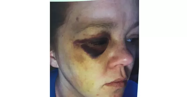 Sheriff Unwittingly Hired St. Albans Officer Involved in Brutality Incident